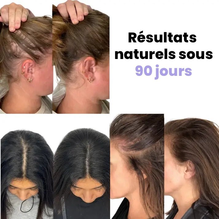 La brosse HairBloom | Novara Paris - NOVARA PARIS
